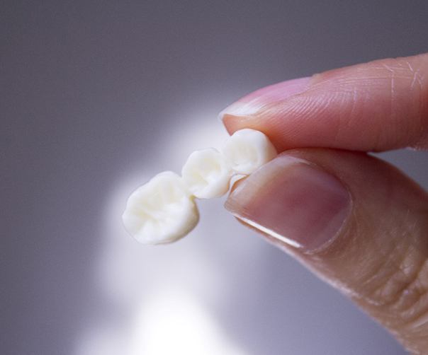 A hand holding a dental bridge in Tyler