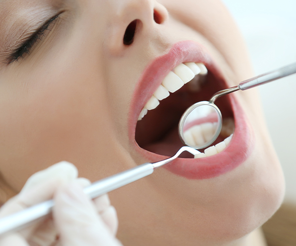 Dentist checking patient's tooth colored fillings