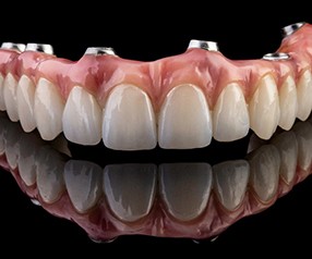 A closeup of implant dentures