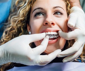 patient undergoing the cost of Invisalign in Tyler