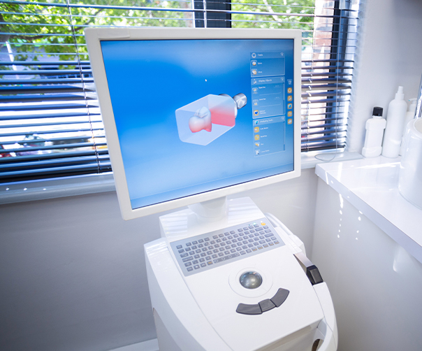 Sirona digital impressions system