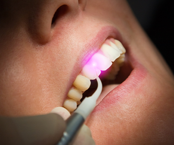 Patient receiving soft tissue laser dentistry