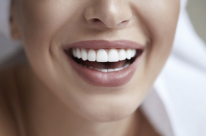 woman wearing white porcelain veneers 