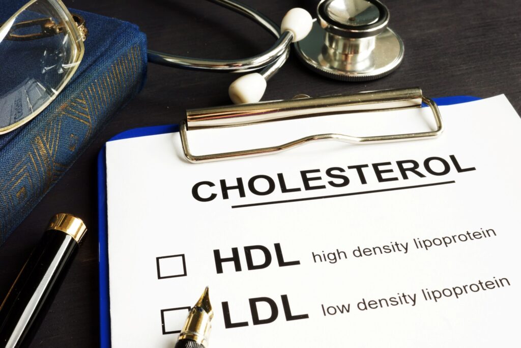 Form on clipboard with Cholesterol HDL and LDL labeled on table next to stethoscope